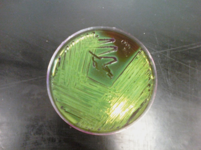 Escherichia coli en medio de cultivo. EMB