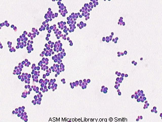 staphylococcus-sp-fig6.jpg