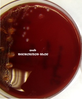 Streptococcus-betahemolisis-agar-sangre