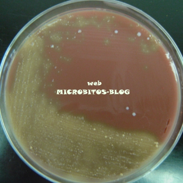 Streptococcus-viridans-alfahemolisis