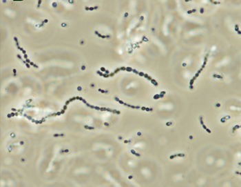Cocos en cadenas Gram (+), Wikipedia: http://upload.wikimedia.org/wikipedia/commons/3/3f/Streptococcus_iniae.png